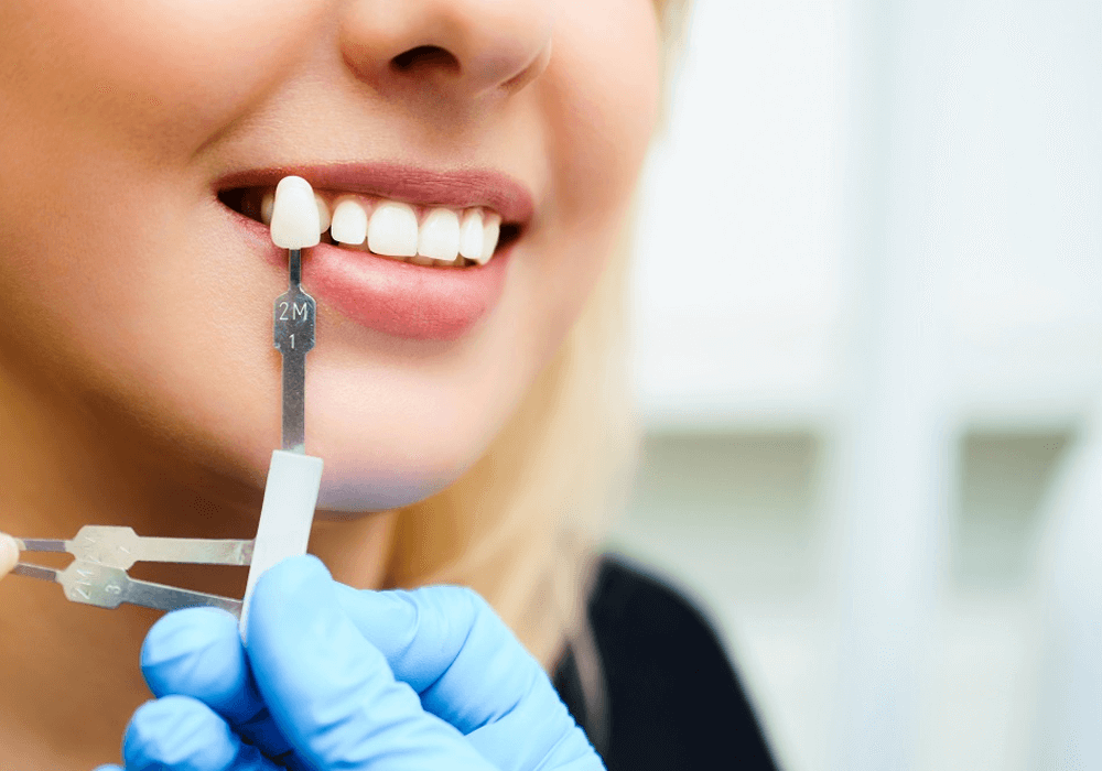 Реставрация (восстановление) зубов