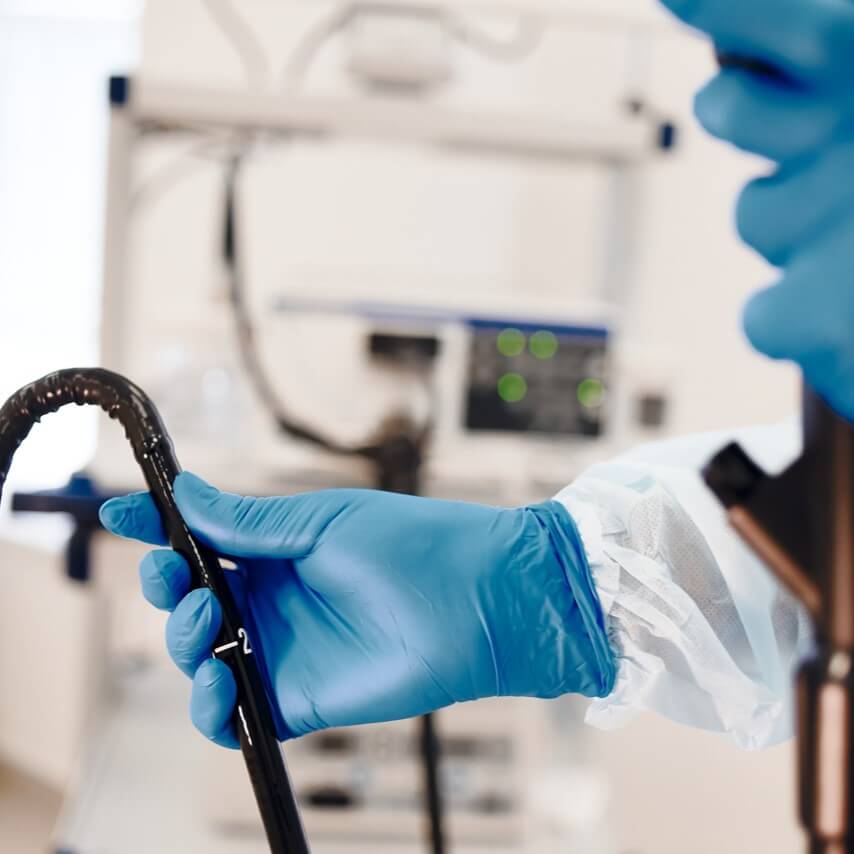 Лигирование варикозно-расширенных вен пищевода